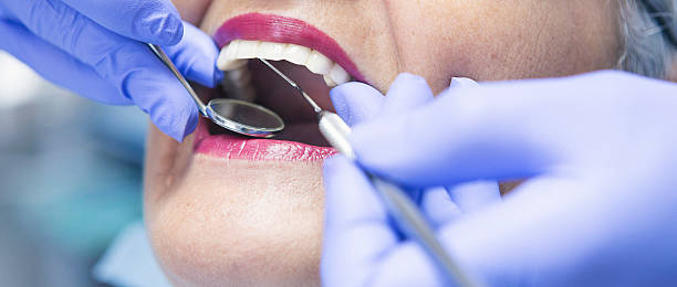 Best Broken or Chipped Tooth Repair in Eudora, AR